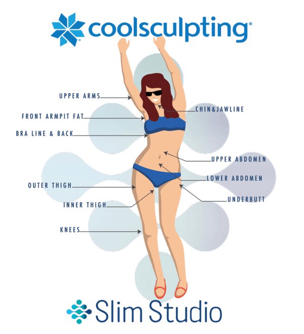 CoolSculpting treats these areas of the body for women