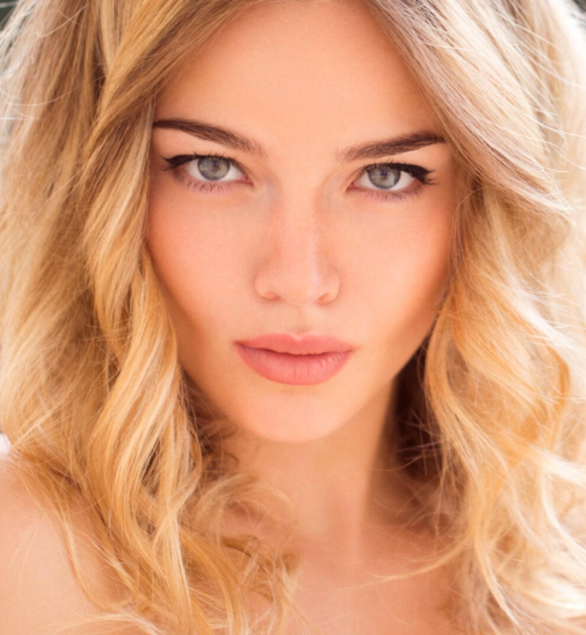Atlanta lip filler model with blonde hair
