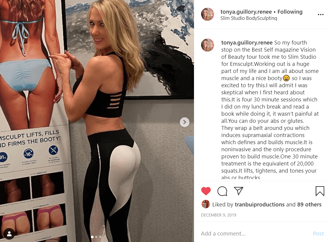 Slim Studio Body Sculpting patient Tonya Guillory