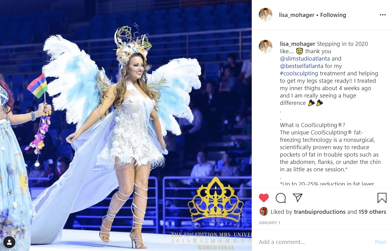 Blogger Lisa Mohager posting about Slim Studio CoolSculpting Center