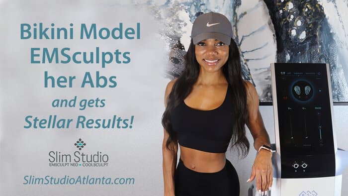 SLIM STUDIO ATLANTA EMSculpt NEO mother model results