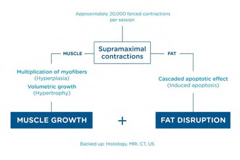 EMSculpt NEO's Game-Changing Technology