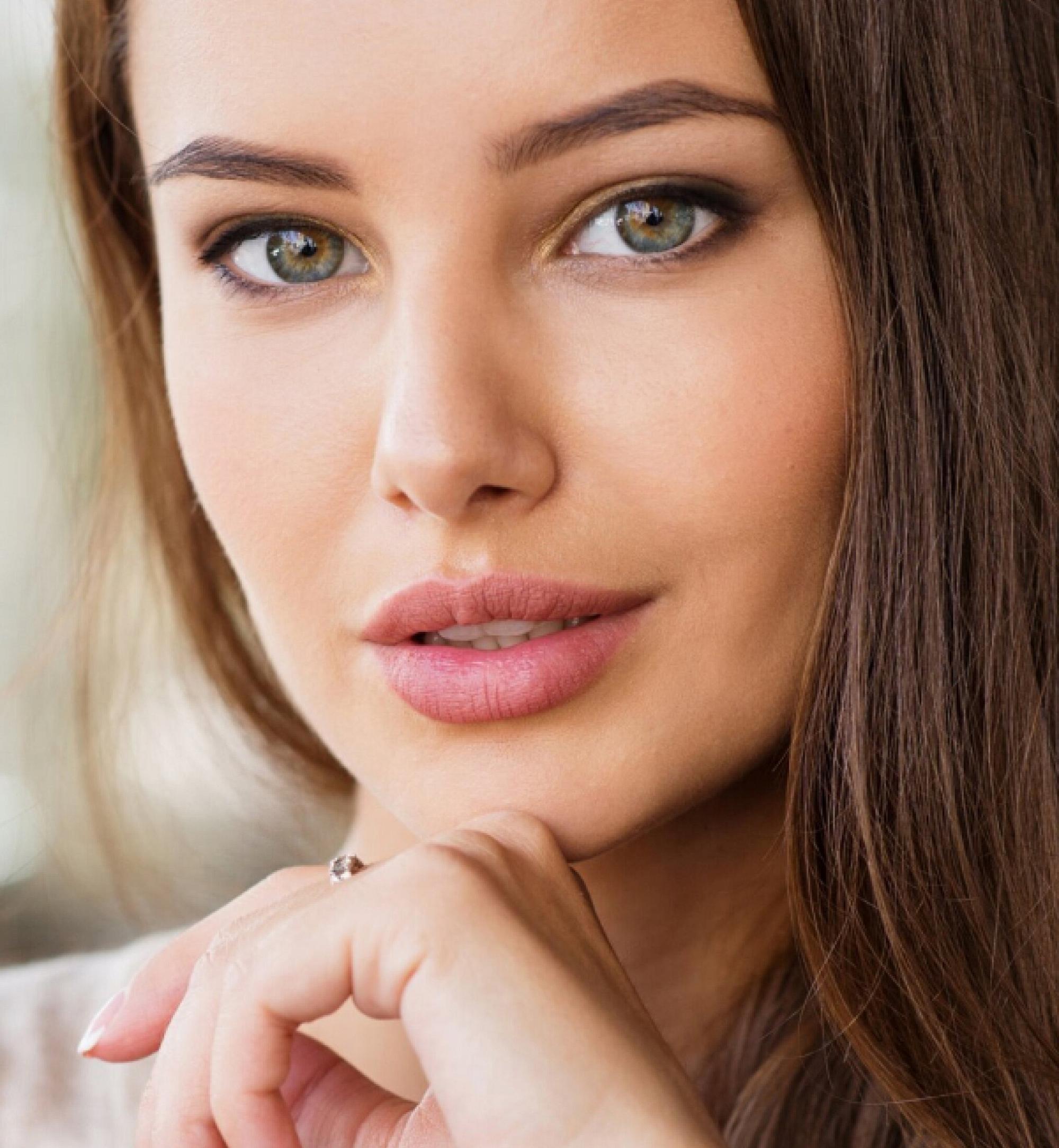 Atlanta radiesse model with dark hair