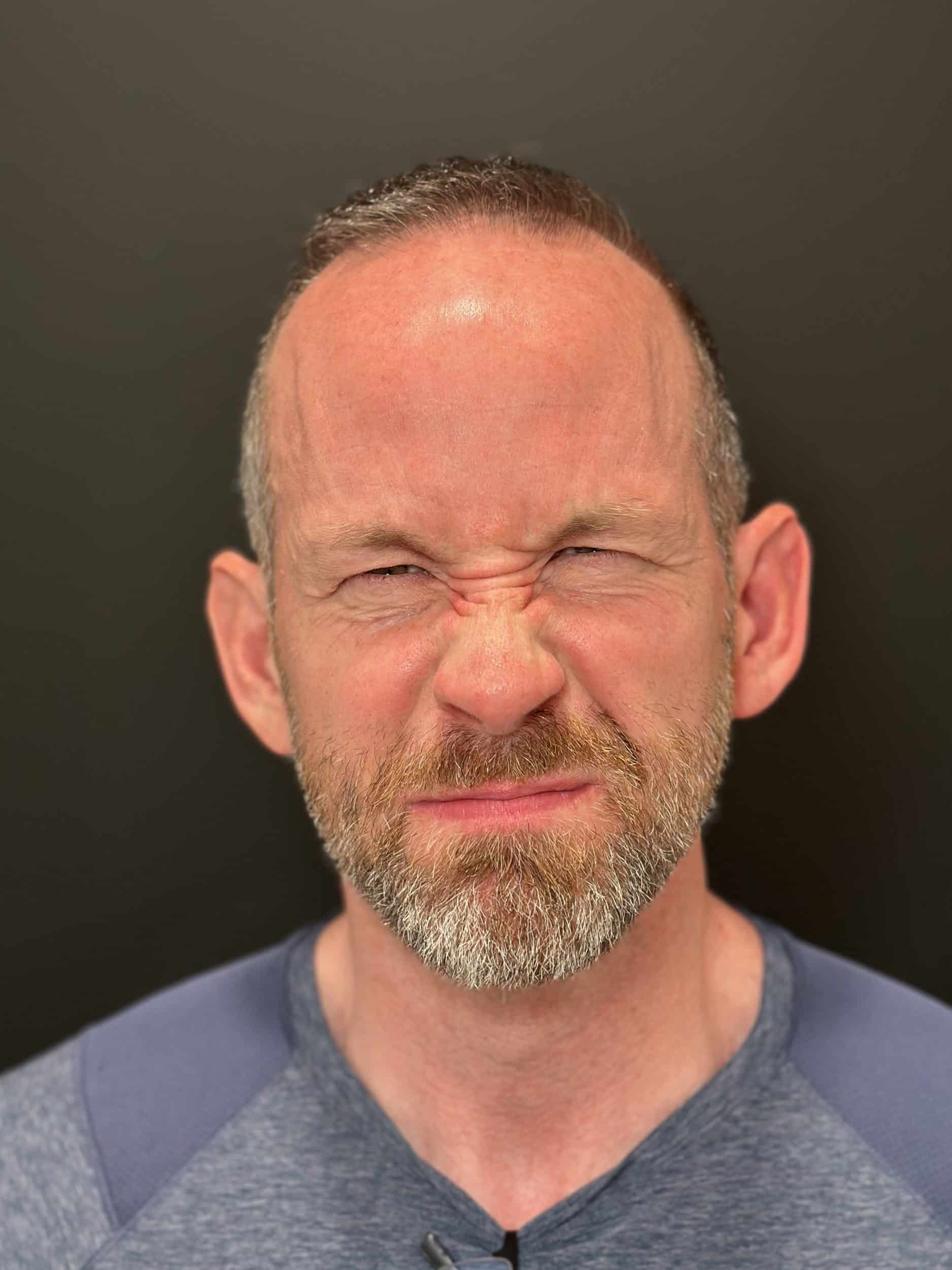 Before Image: Neurotoxin - front