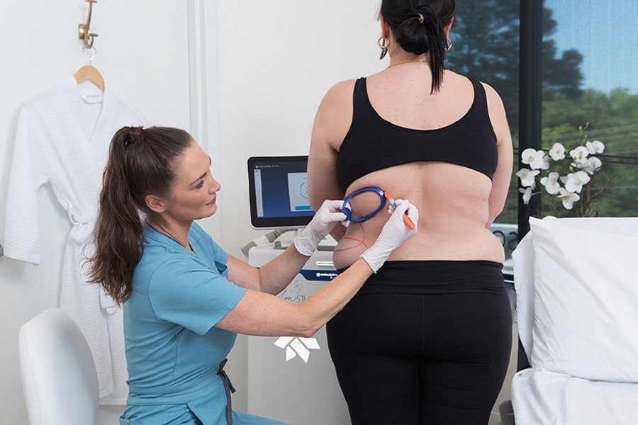 Repl_CS Treatment in Atlanta_Svc pg_CS Tx_F Flanks_Ash tx Mia_4.2026 CoolSculpting In Atlanta